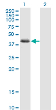 NDRG2 monoclonal antibody (M03), clone 6A5