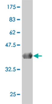 NDRG2 monoclonal antibody (M03), clone 6A5