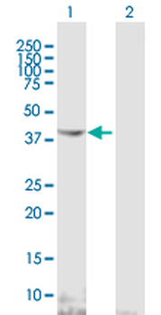 NDRG2 MaxPab mouse polyclonal antibody (B01)