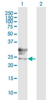TMEM27 purified MaxPab mouse polyclonal antibody (B01P)