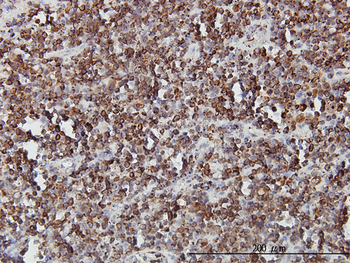 SLC44A2 monoclonal antibody (M01), clone 3D11