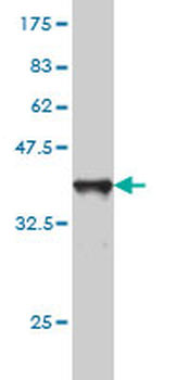 SLC44A2 monoclonal antibody (M01), clone 3D11