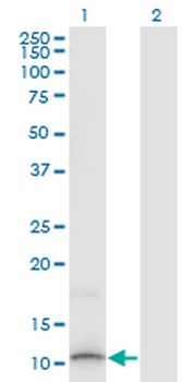 SLURP1 monoclonal antibody (M06), clone 4D1