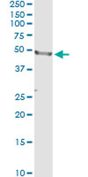 CD177 monoclonal antibody (M01), clone 4C4