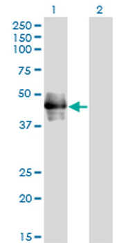 CD177 monoclonal antibody (M01), clone 4C4