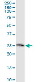 TWSG1 monoclonal antibody (M07), clone 2F3