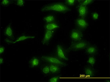 AKR1B10 monoclonal antibody (M01), clone 1A6