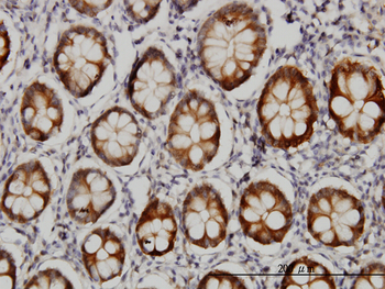 AKR1B10 monoclonal antibody (M01), clone 1A6