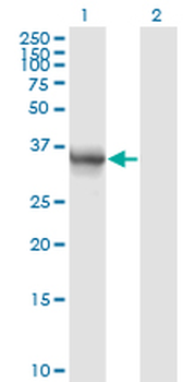 AKR1B10 monoclonal antibody (M01), clone 1A6