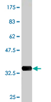 AKR1B10 monoclonal antibody (M01), clone 1A6