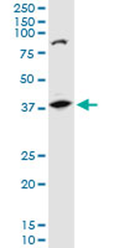 AKR1B10 polyclonal antibody (A01)