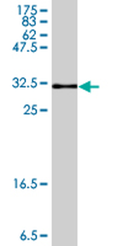 AKR1B10 polyclonal antibody (A01)