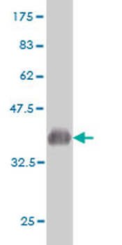 CABC1 monoclonal antibody (M04A), clone 7G1