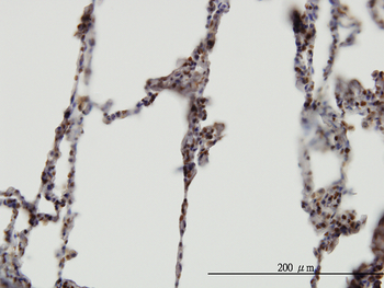 XAB2 monoclonal antibody (M01), clone 1D1-1A9