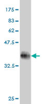 DUSP22 monoclonal antibody (M01), clone 3D3