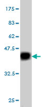 C1GALT1 monoclonal antibody (M01), clone 1F1