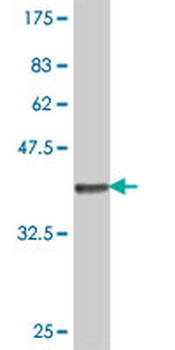 C1GALT1 polyclonal antibody (A01)