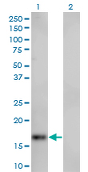 SPIRE1 monoclonal antibody (M01), clone 4C5
