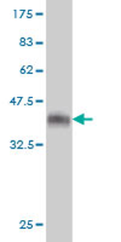 SPIRE1 monoclonal antibody (M01), clone 4C5