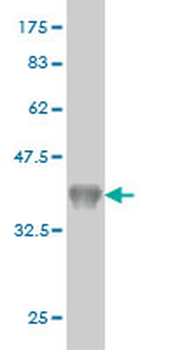 CYP26B1 monoclonal antibody (M01), clone 1H6