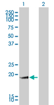 GKN1 monoclonal antibody (M01), clone 2E5