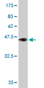 GKN1 monoclonal antibody (M01), clone 2E5