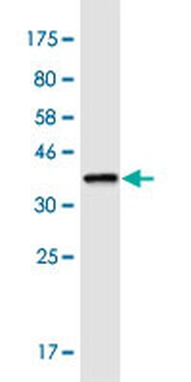 LRRC8A monoclonal antibody (M04), clone 8H9