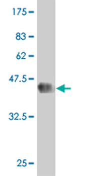DMAP1 monoclonal antibody (M01), clone 2G12