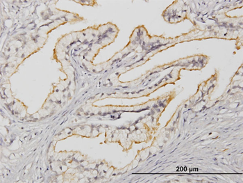 APOB48R monoclonal antibody (M03), clone 2D7