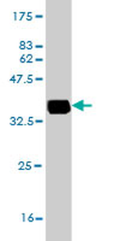 APOB48R monoclonal antibody (M03), clone 2D7