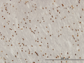 ZNF313 monoclonal antibody (M01), clone 4G3-1A10