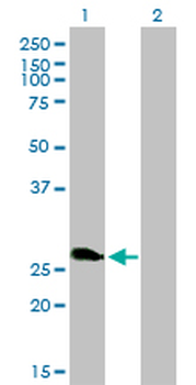 ZNF313 monoclonal antibody (M01), clone 4G3-1A10