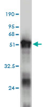 ZNF313 monoclonal antibody (M01), clone 4G3-1A10