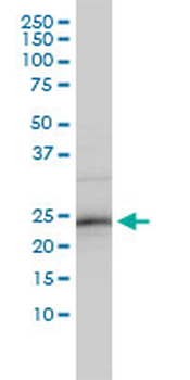 ZNF313 monoclonal antibody (M01), clone 4G3-1A10