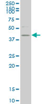 HDAC8 monoclonal antibody (M01), clone 2F4