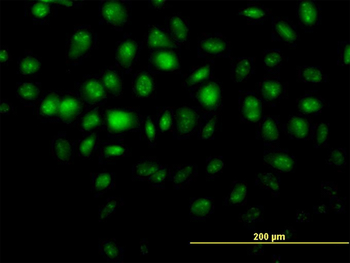HDAC8 monoclonal antibody (M01), clone 2F4