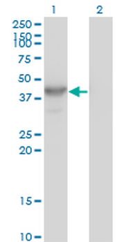 HDAC8 monoclonal antibody (M01), clone 2F4
