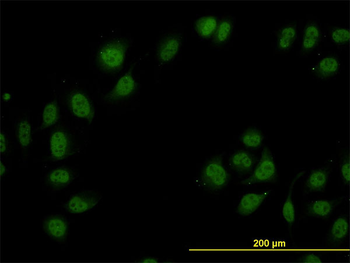CAND1 monoclonal antibody (M01), clone 5D7