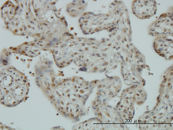 CAND1 monoclonal antibody (M01), clone 5D7