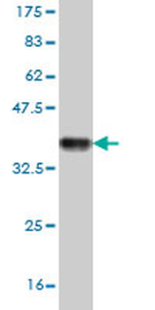 CAND1 monoclonal antibody (M01), clone 5D7