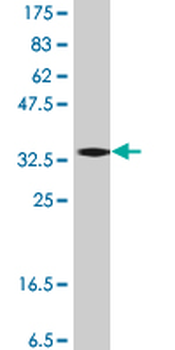 DCP1A polyclonal antibody (A01)