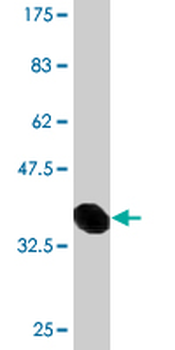 DEPDC1B monoclonal antibody (M01), clone 2H2