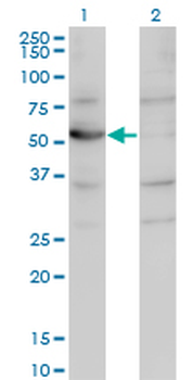 CNDP2 monoclonal antibody (M09), clone 1B1