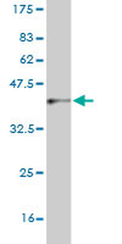 CNDP2 monoclonal antibody (M09), clone 1B1
