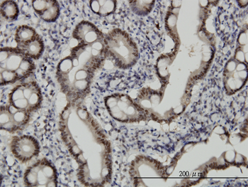 CHFR monoclonal antibody (M01), clone 1H3-A12