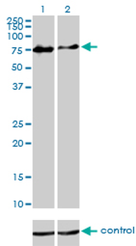 CHFR monoclonal antibody (M01), clone 1H3-A12