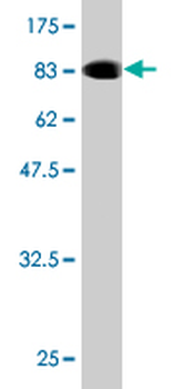 CHFR monoclonal antibody (M01), clone 1H3-A12