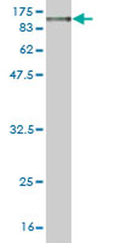 MFN1 monoclonal antibody (M04), clone 3C9