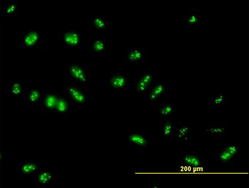 LYAR purified MaxPab mouse polyclonal antibody (B01P)
