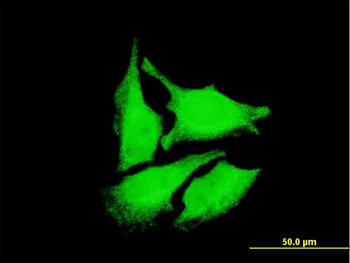 DEPDC1 monoclonal antibody (M05), clone 6H1